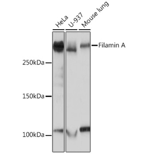 Filamin A Rabbit mAb
