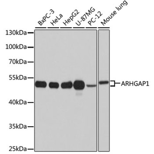 ARHGAP1 Rabbit pAb
