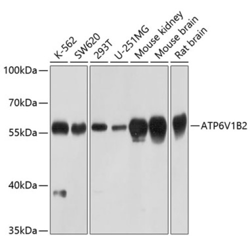 ATP6V1B2 Rabbit pAb
