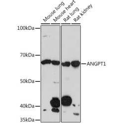 ANGPT1 Rabbit mAb