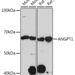 ANGPT1 Rabbit mAb