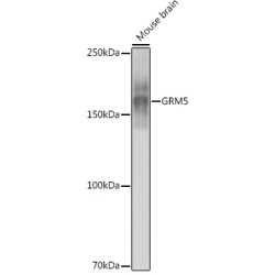 GRM5 Rabbit mAb