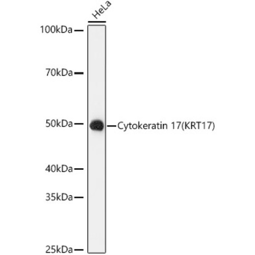 Cytokeratin 17 (KRT17) Rabbit mAb