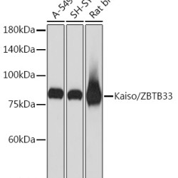 Kaiso/ZBTB33 Rabbit mAb