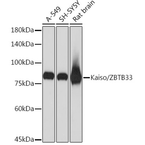 Kaiso/ZBTB33 Rabbit mAb