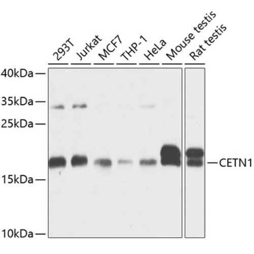 CETN1 Rabbit pAb