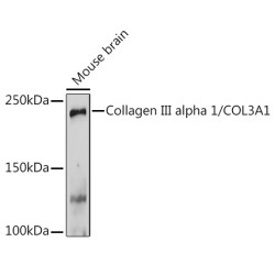 Collagen III alpha 1/COL3A1 Rabbit pAb