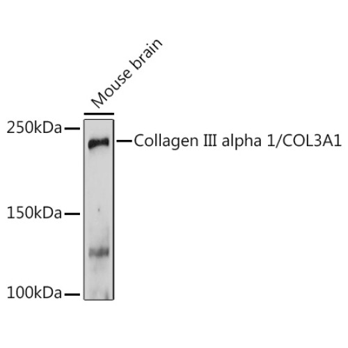 Collagen III alpha 1/COL3A1 Rabbit pAb