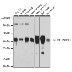 NUDEL/NDEL1 Rabbit mAb