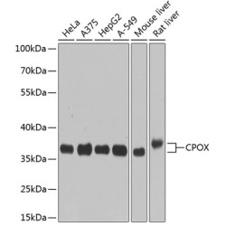 CPOX Rabbit pAb