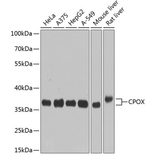 CPOX Rabbit pAb