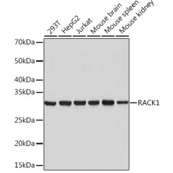 RACK1 Rabbit mAb