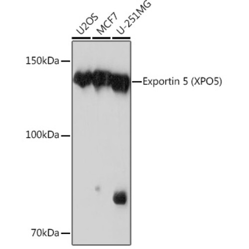 Exportin 5 (XPO5) Rabbit mAb