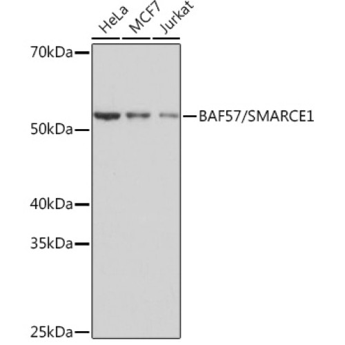 BAF57/SMARCE1 Rabbit mAb
