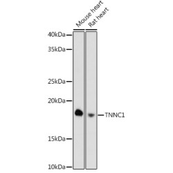 TNNC1 Rabbit mAb