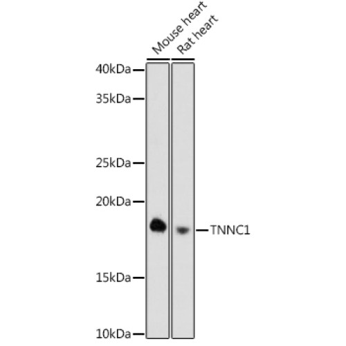 TNNC1 Rabbit mAb