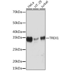 TREX1 Rabbit mAb
