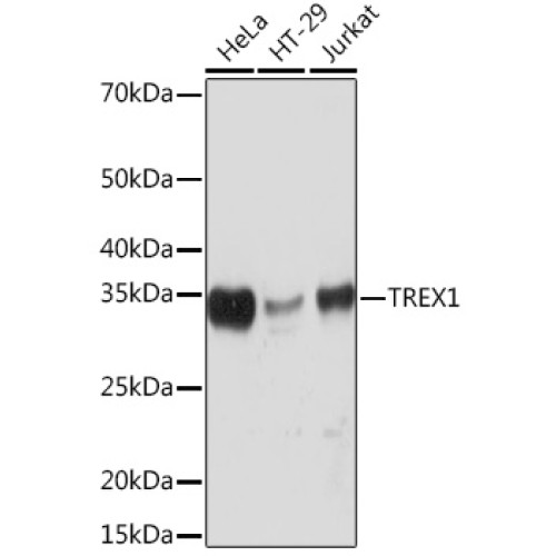 TREX1 Rabbit mAb