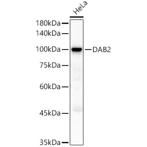 DAB2 Rabbit pAb