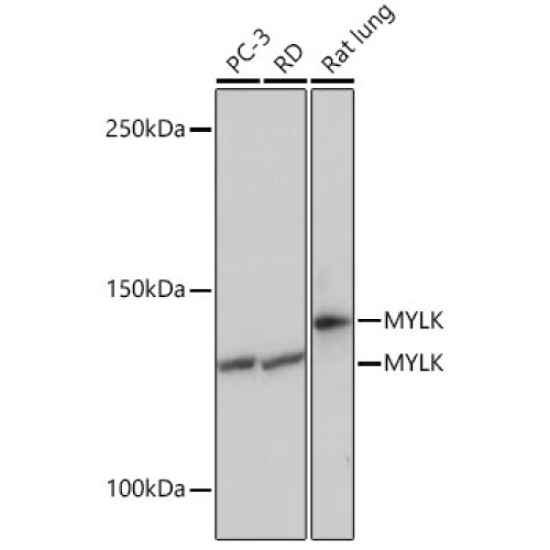MYLK Rabbit mAb