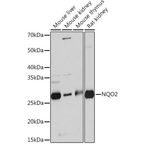 NQO2 Rabbit mAb