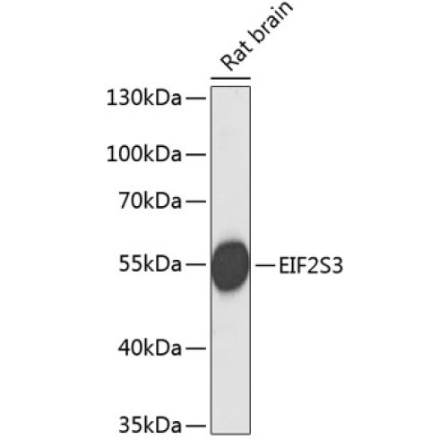 EIF2S3 Rabbit pAb