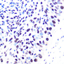 53BP1 Rabbit mAb