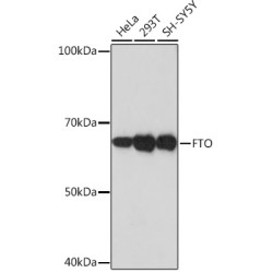 FTO Rabbit mAb