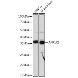 AKR1C3 Rabbit mAb