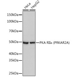 PKA RIIα (PRKAR2A) Rabbit mAb