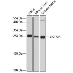 GSTM3 Rabbit pAb