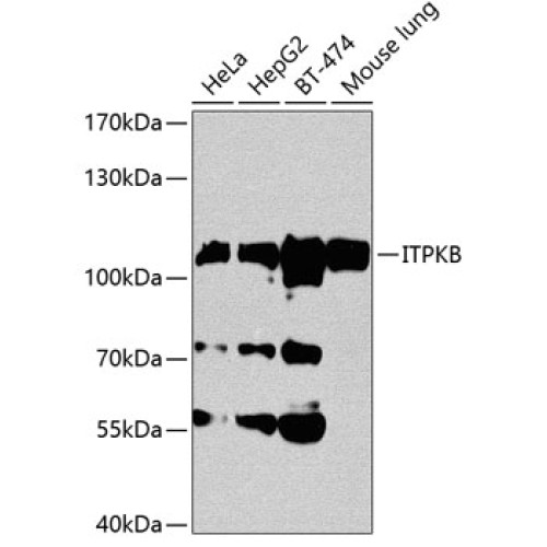 ITPKB Rabbit pAb