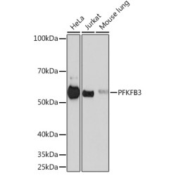PFKFB3 Rabbit mAb