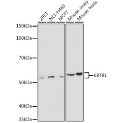 KRT81 Rabbit pAb