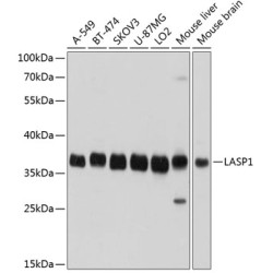 LASP1 Rabbit pAb