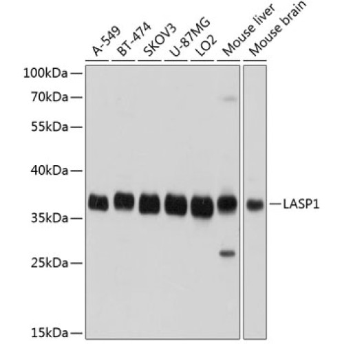 LASP1 Rabbit pAb