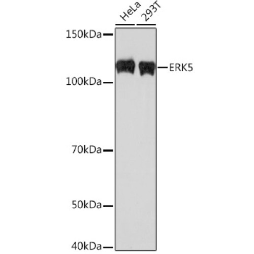 ERK5 Rabbit mAb