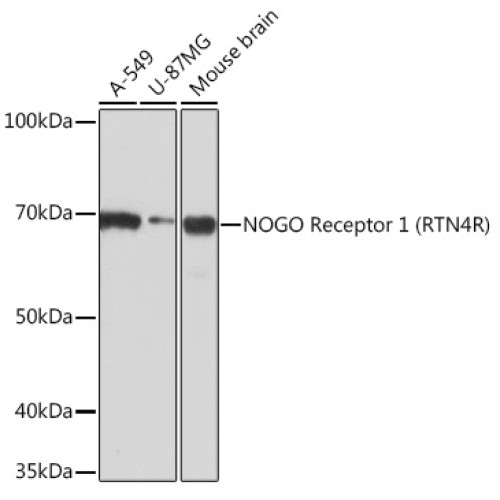 NOGO Receptor 1 (RTN4R) Rabbit mAb