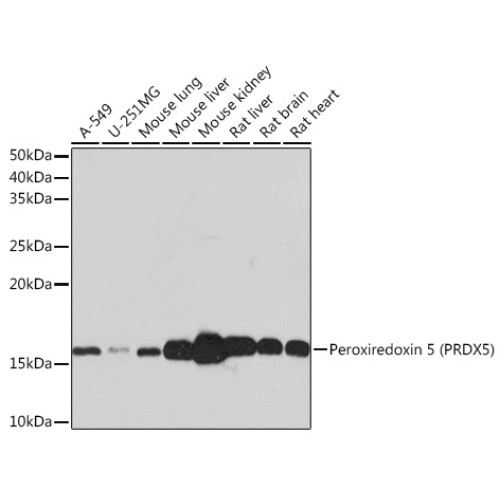 Peroxiredoxin 5 (PRDX5) Rabbit mAb