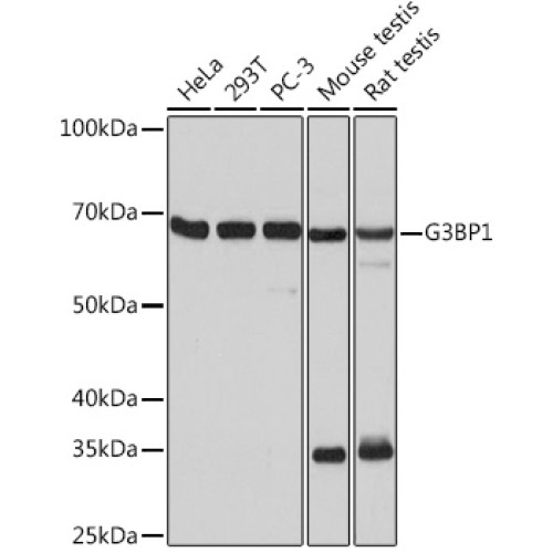 G3BP1 Rabbit mAb