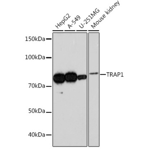 TRAP1 Rabbit mAb