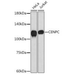 CENPC Rabbit mAb
