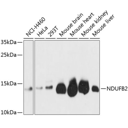 NDUFB2 Rabbit pAb
