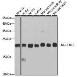 NDUFB10 Rabbit pAb