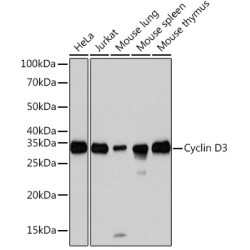 Cyclin D3 Rabbit mAb