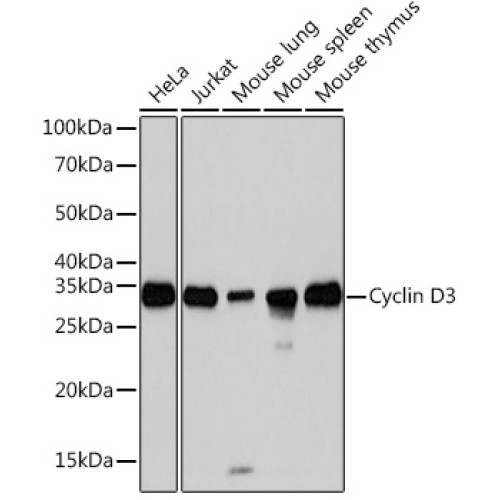Cyclin D3 Rabbit mAb