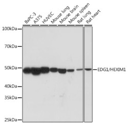 EDG1/HEXIM1 Rabbit mAb