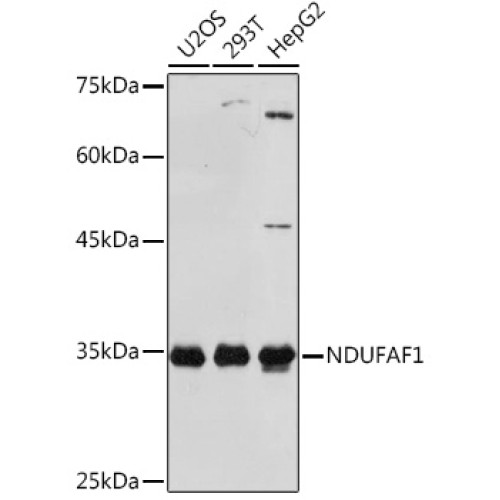 NDUFAF1 Rabbit mAb