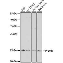 PFDN5 Rabbit pAb