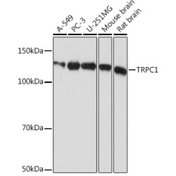 TRPC1 Rabbit mAb